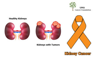 Kidney_Cancer