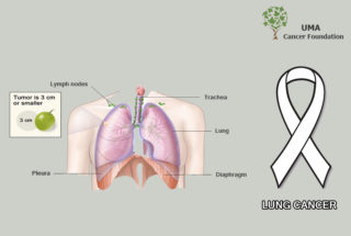 Lung_Cancer